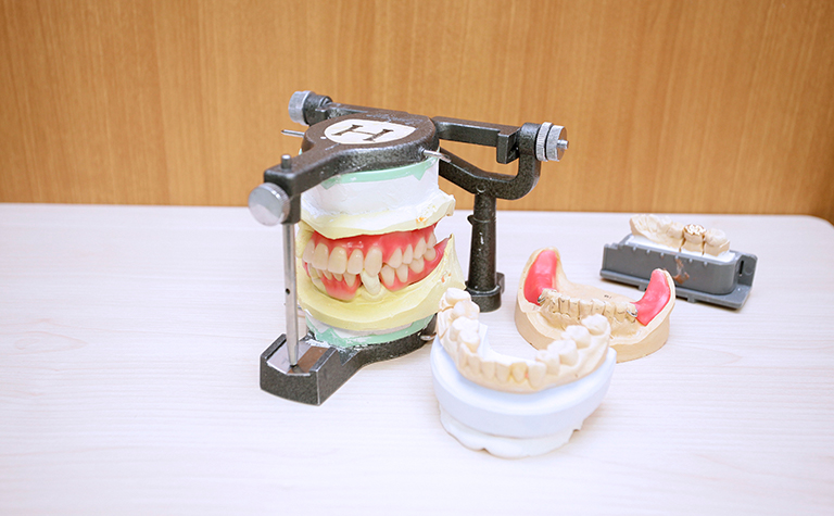 院内歯科技工物